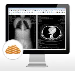 Merge eFilm Workstation 4.1 (2015) торрент скачать
