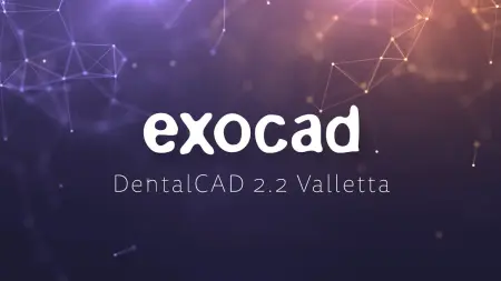 EXOCAD Valletta 2.2.6654 (2018) торрент скачать