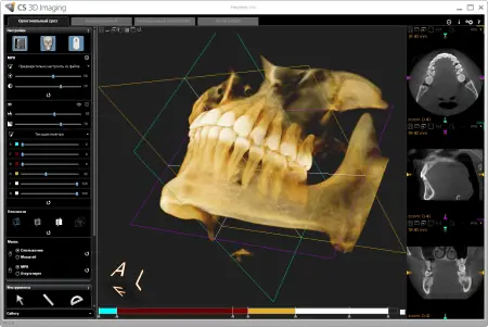 CS 3D Imaging Software 3.1.9.0 (2011) торрент скачать
